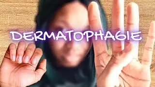 Arrêter de manger ses peaux (Dermatophagie)