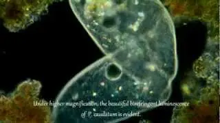 Birefringence in Paramecium caudatum. Darkfield and polarized Light. 225-900X