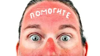 Обгорело лицо - Тогда этот рецепт для вас. Что делать если сгорел на солнце