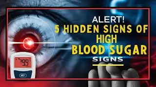 5 Hidden Signs of High Blood Sugar