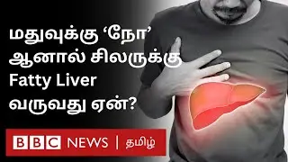 'மது' குடிக்காதவங்களுக்கு கூட Fatty Liver வருவது ஏன்? இதற்கு என்ன அறிகுறி தெரியுமா? Explained