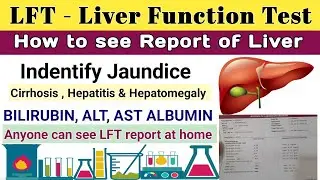LFT - Liver Function Test - How to see report || AST, ALP, Bilirubin, ALT