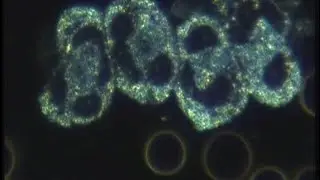 Can I Buy a Cheaper Microscope Online for Live Blood Analysis? - Live Blood Analysis Training Course