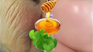 สูตรหน้าเด็ก ขาวใส ด้วยน้ำผึ้ง  Honey will make youan 18-year-old girl no matter yourage.