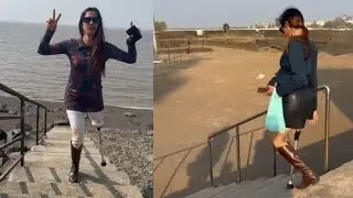 Amputee Lady Life After Amputation: Learning to Use the Stairs Again