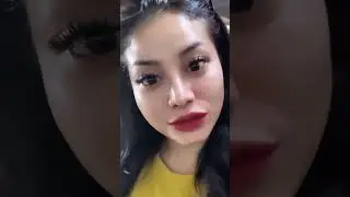 Baby Feriosa 305th Day 