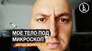 ЧЕРВИ В ГЛАЗУ. СОПЛИ, НОГТИ, СЛЮНИ ПОД МИКРОСКОПОМ
