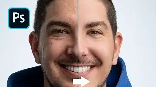Skin Retouching in Photoshop | Frequency Separation | Perfect Skin | Photoshop Tutorial