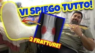 MI SONO FRATTURATO I MALLEOLI 🤕 - VI SPIEGO ALCUNE COSE...