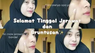 SKINCARE TREATMENT UNTUK JERAWAT! ERHA ACNEACT BIKIN KULIT HALUS BYE ACNE! BUKTIIN AJA DEH!😍