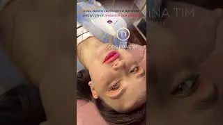 Инстаграм -doc.irina.tim 💉👄 Воронеж - самый плоский бант 🎀 #воронеж #косметолог