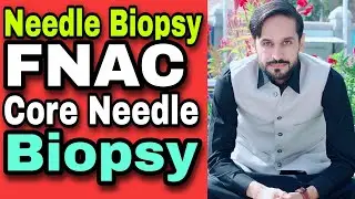 Needle Biopsy and Types | FNAC