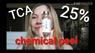 TCA 25% Chemical Peel