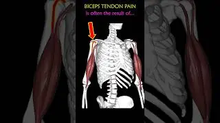 Fix Pain at the Front of your Shoulder