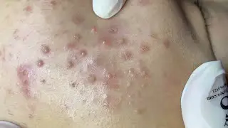 Satisfying Relaxing with Sac Dep Spa 