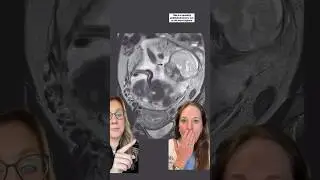 If it wasn’t in a medical journal - I couldn’t believe it I’d true - incredible! 