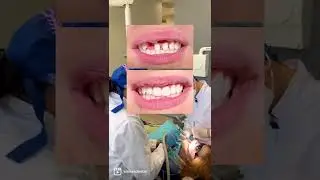 Smile Transformation In Edmonton, Alberta.