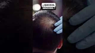 👉 Haz CRECER tu PELO con MINOXIDIL ✨👑✂️ #calviciefeminina #minoxidil #crecimientodepelo #alopecia
