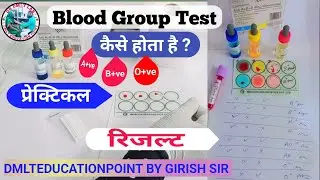 ABO blood group | Blood Group Test in Hindi | Blood group |RH-Factor (+ve/+ve) in hindi #bloodgroup