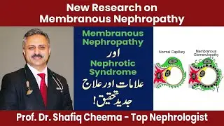 New Research on Membranous Nephropathy, Causes & Treatment #nephropathy #ckd #nephroticsyndrome