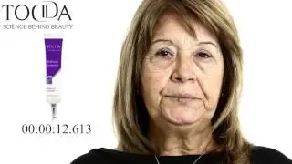 שקיות מתחת לעיניים? עיניים נפולות ועייפות? שחורים סבבי העיניים? סימני הגיל?