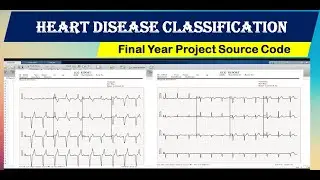 Heart Disease Classification Using Machine Learning  | Heart Disease Detection Using Matlab