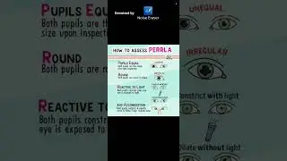 PERRLA