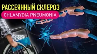 ХЛАМИДИИ | РАССЕЯННЫЙ СКЛЕРОЗ | chlamydia pneumonia