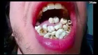you Laugh -1 times, you Restart 👽