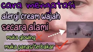 cara mengatasi alergi cream wajah secara alami