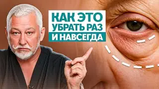 Отеки и мешки под глазами. Скрытые причины и 3 неожиданных решения