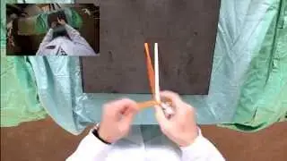 Перекрест нитей