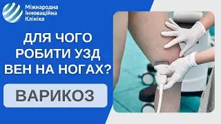 Коли потрібно робити УЗД вен на ногах? Що найважливіше у діагностиці хвороби вен на ногах?