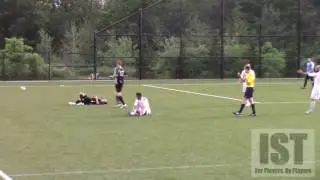 BROKEN ARM!!!!!!!  YOU CAN HEAR THE SOUND OF THE BREAK DURING THE CORNER CAM REPLAY!!!!!