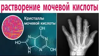 All doctors drink this tea. It lowers uric acid levels and treats gout.