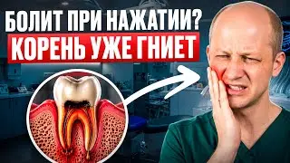 ♦️ Воспаление корня зуба