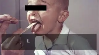Early Warning Signs of Cancer Most People Ignore | Best Health Answers