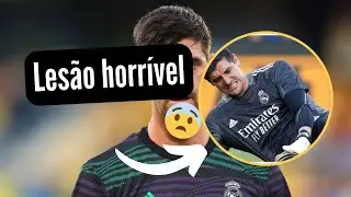A Queda do Gigante: Courtois e a Lesão que Abalou o Futebol!