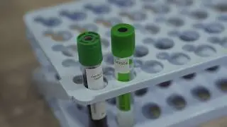 Плазмолифтинг в клинике 