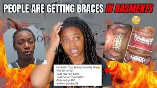 FAKE DENTISTS Are Straightening Teeth In Their Basements 😶 |The DIY Braces Saga