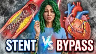 Your arteries after smoking for years | Stent VS Bypass 🫀