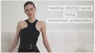 Жизнь после акне [ Уход, лазерная шлифовка ]