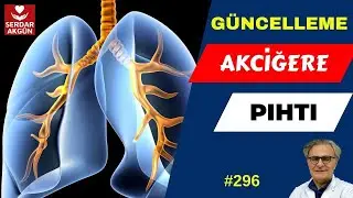 296. Damarda Pıhtı, Akciğere Pıhtı Atması, Serdar Akgün, Sağlıklı Yaşam