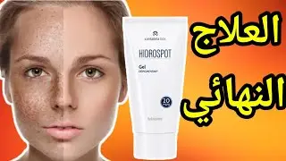 HIDROSPOT gel افضل منتوج معالج للتصبغات الجلدية بدون منازع👌اسرار نجاحه وسبب فشل بعض الحالات 🧐