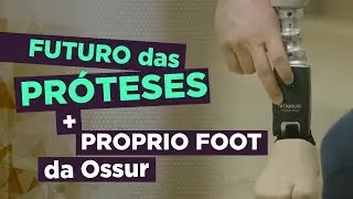 The Future of Prosthetics + Proprio Foot, Ossur