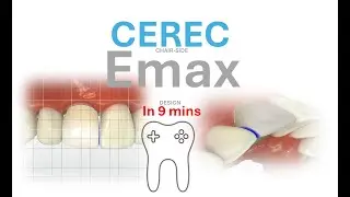 CEREC chairside Emax design Tutorial in 10mins- Grid mode- Copy & Mirror - Incisal variations