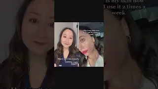 Dermatologist Reacts to DAILY Tretinoin Use 
