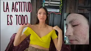 ATRACTIVA con la piel "MAL"? | SÍ, puedo hacerlo TODO con MI piel !!