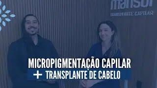 Micropigmentação capilar + Transplante Capilar #transplantecapilarfue  #micropigmentaçãocapilar