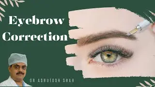 Powder Brow Procedure, Eyebrow Correction, Powder Brow, Painless Treatment in Mumbai, Nasuk, Surat